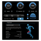 Infinium Focus focused shockwave therapy touchscreen treatment interface with energy and frequency controls